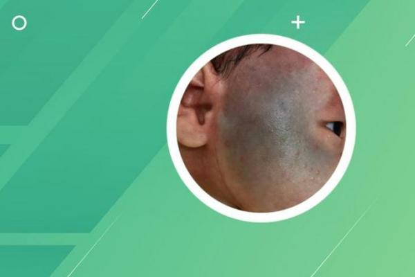 男婴眉心长“月牙”胎记，母亲带他算命后神秘失踪，至今下落不明